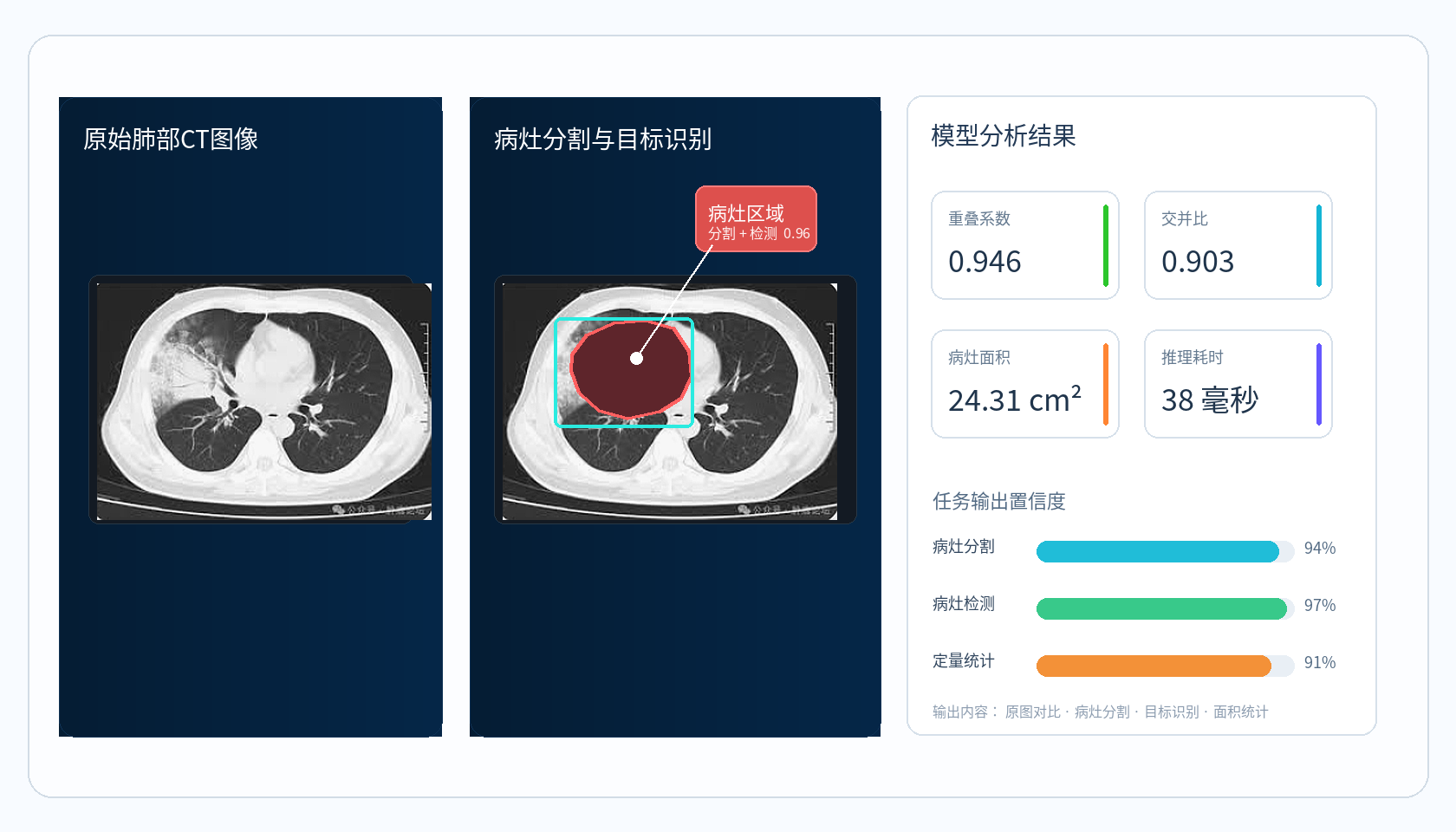 医疗AI影像分析示意